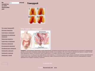 геморроя нет
http://gemorounet.narod.ru/